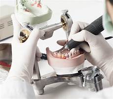 protesi dentali mobili protesi dentali fisse o mobili lg dental center protesi dentali mobili protesi dentali fisse o mobili lg dental center