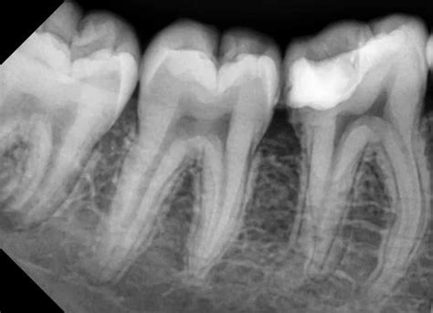 Vatech Rvg Dental Intra Oral Imaging Sensor Trader - Wholesaler ...