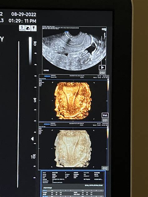 Please help this is my last resort : r/obgyn