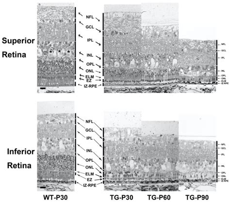 Monitoring Retinal Degeneration in a Porcine Model of Retinitis ...