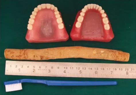 S. persica chewing sticks and toothbrush, and standard toothbrush ...