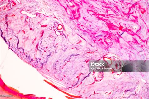 Image result for Finger Under Microscope