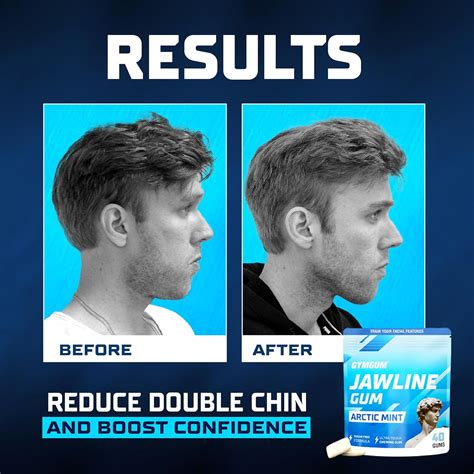 Gymgum Jawline Gum | Hard Chewing Gum For Jaw India | Ubuy