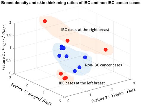 Imaging Modalities in Inflammatory Breast Cancer (IBC) Diagnosis: A Computer-Aided Diagnosis ...