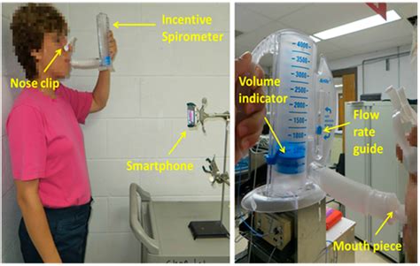 Employing an Incentive Spirometer to Calibrate Tidal Volumes Estimated ...