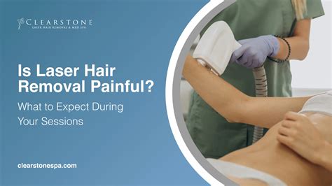 Is Laser Hair Removal Painful? What to Expect During Your Sessions