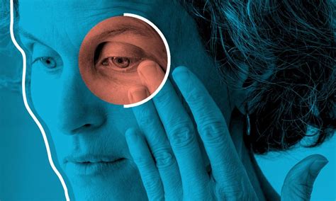 Squeezing and rubbing of eyelids substantially increases IOP in ...