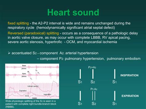 Heart sound auscultation.ppt