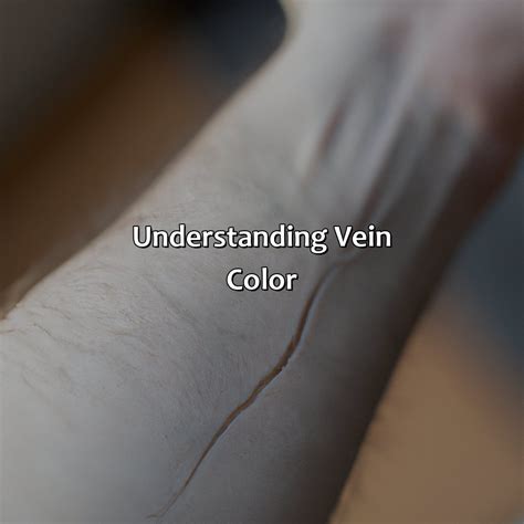 What Color Light Is Best For Veins at Janelle Mayo blog