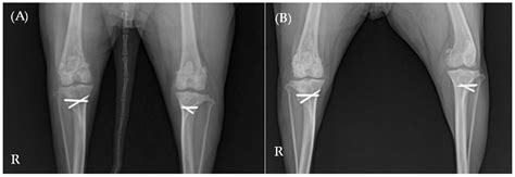 Diagnosis and Management of Chronic Nonbacterial Osteomyelitis in a Dog