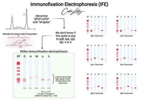 Serum Protein Electrophoresis Scan at Erin Patteson blog