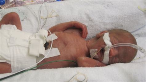 An Open Letter to Preemie Parents From a Micro Preemie Mom | HuffPost