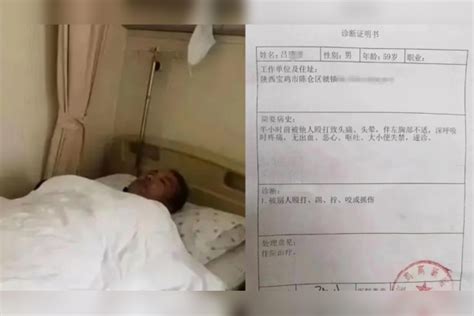 网传陕西宝鸡一中学校长被教育局长喊人打伤，警方回应