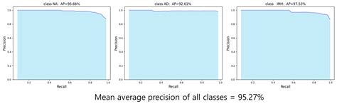 Detection of Aortic Dissection and Intramural Hematoma in Non-Contrast ...