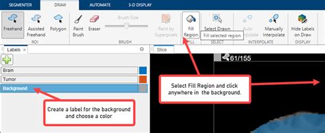 Image result for Volume Segmenter MATLAB Tutorial