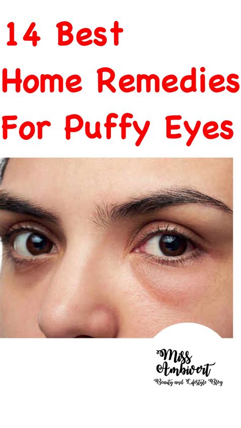 Swollen Eyes Treatment Diy at Matilda Neil blog