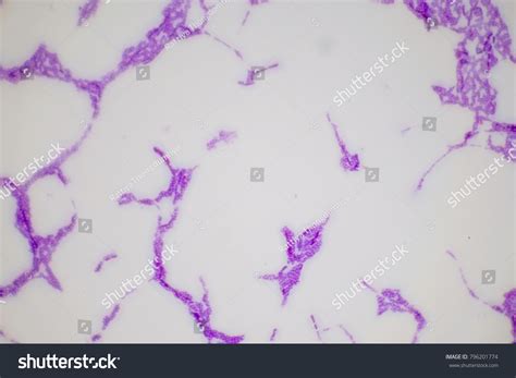 Image result for Bacteria Microscope Slides