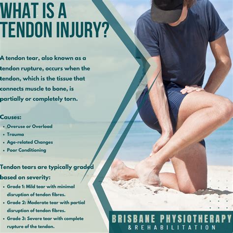 What are Tendon Tears? - Brisbane Physiotherapy & Podiatry