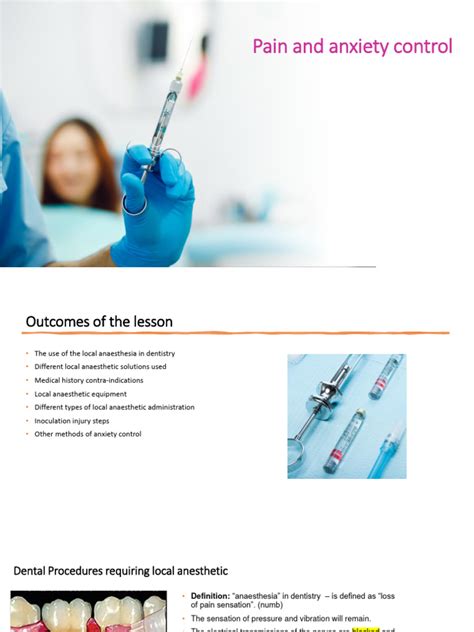 Extraoral Technique of Local Anesthesia 的图像结果