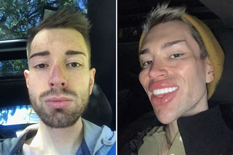 Ken And Barbie Real Life Before And After Official Trailer