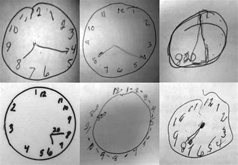 Image result for Mini-Cog Testing