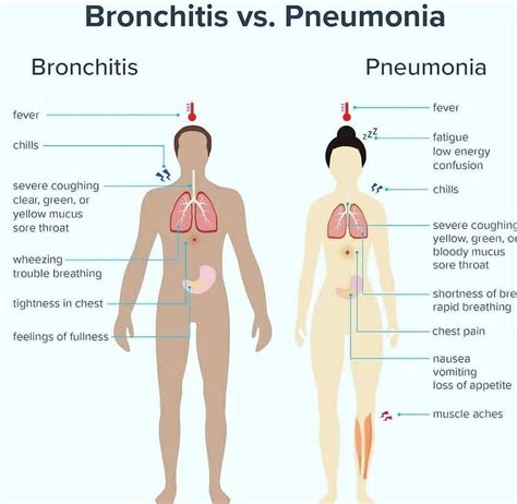 Bronchitis Vs Pneumonia