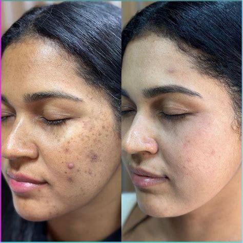 Dosha Mapped Skincare, Haircare and Diet Transformation Program ...