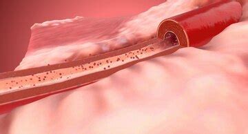 Sodium and aldosterone high blood pressure | Premium Photo