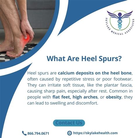 Heel Spurs: Pain Relief Strategies and When to See a Podiatrist - Skylake Medical Associates