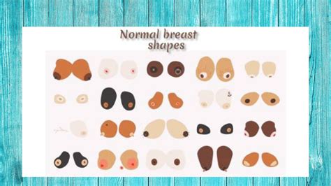 Normal Breast Shapes In 9 Different Types In this article, we will come ...