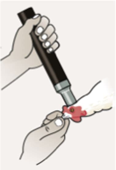 Image result for Peritoneum Injection