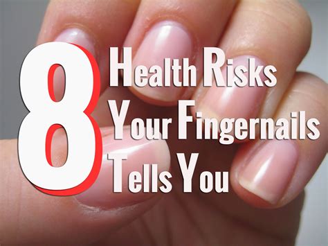 Zinc Deficiency Symptoms On Nails at Darla Urena blog