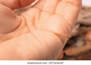 Image result for Splinter in Hand