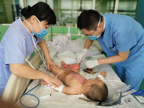 小儿烧伤整形外科-青岛市妇女儿童医院--青岛大学附属妇儿医院