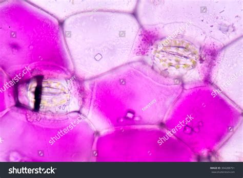 Plant Cell Under Microscope 400x