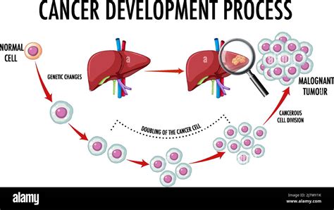 How Does Cancer Develop 的图像结果
