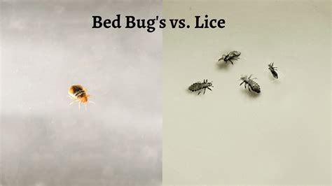 Bed Bugs vs. Lice: What You Need To Know - The Pest Rangers