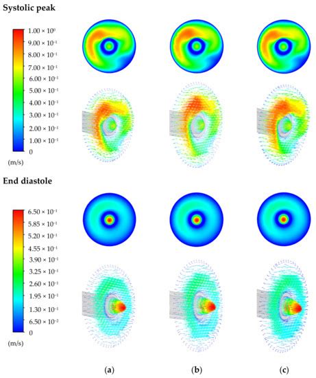 Mathematics | Special Issue : Numerical Simulation in Biomechanics and ...