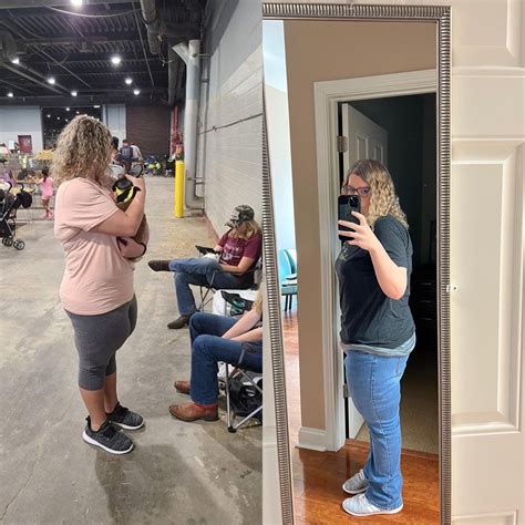 Before and after thigh lift. : r/PlasticSurgery