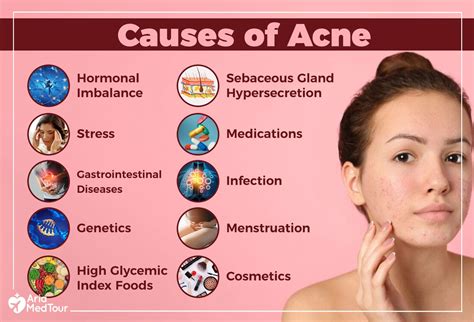 Can Heat Cause Acne at Adam Goudeau blog