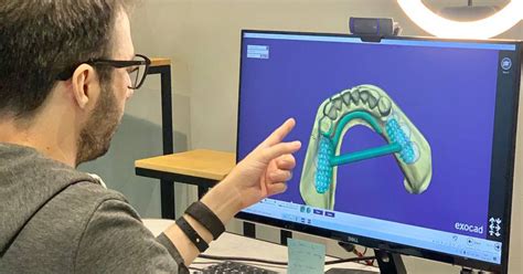 Видеокурс. Моделирование бюгельных протезов в Exocad - CAD CAM Academy ...