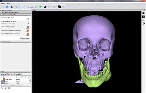 InVesalius Tutorial 的图像结果