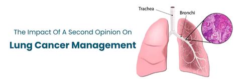 Impact of a Second Opinion on Lung Cancer Management