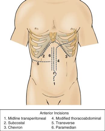 Image result for Open Nephrectomy Procedure