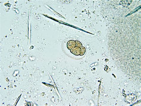 Hookworms Eggs