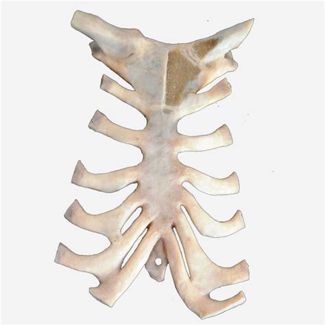 P3007 – Sternoclavicular and Sternocostal Joints | Prosections