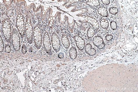 IHCeasy MYO19 Ready-To-Use IHC Kit KHC0362 | Proteintech