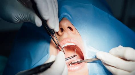 Oral & maxillofacial surgery Turkey: procedures, benefit, recovery