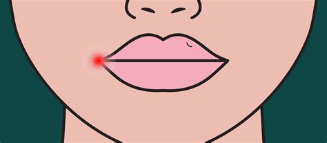 Tiny Bumps on Lips: Should You Be Concerned?