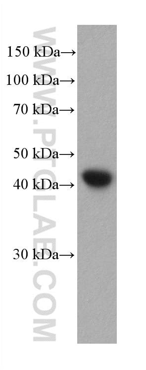 Alpha smooth muscle actin specific antibody (67735-1-Ig) | Proteintech